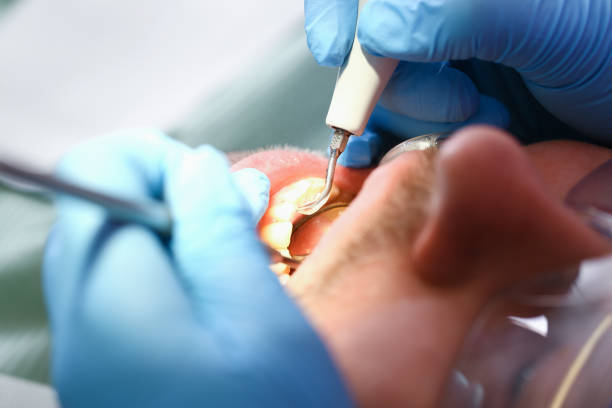 Best Walk-In Emergency Dentist in Slippery Rock, PA