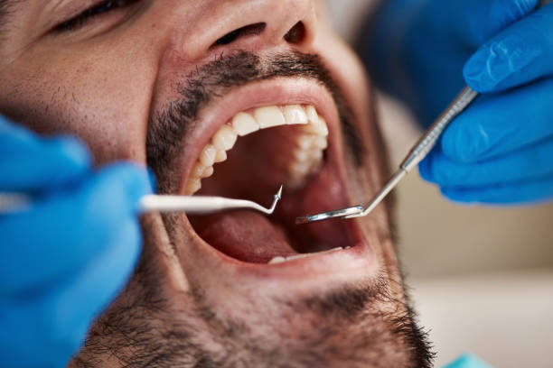 Best Emergency Treatment for Toothache in Slippery Rock, PA