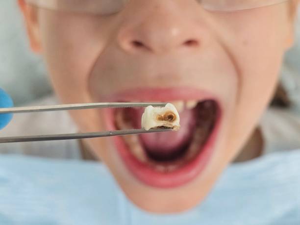 Best Emergency Broken Tooth Repair in Slippery Rock, PA